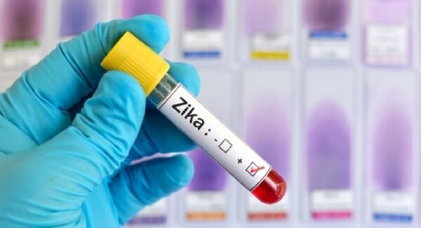 Вылечит ли вирус Зика рак мозга?