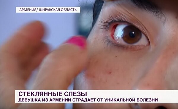 Девушка из Армении плачет хрустальными слезами