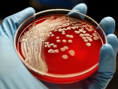 Последствия устойчивости бактерий к антибиотикам могут вызвать пандемию в условиях пандемии. В Lancet опубликовано исследование